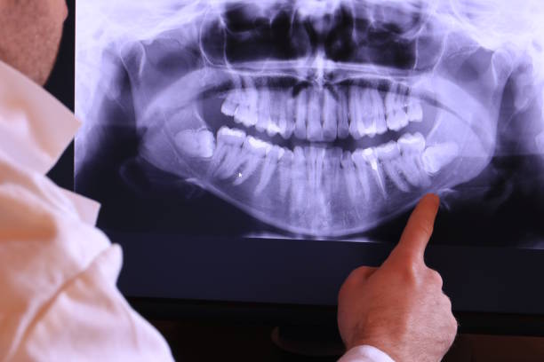 Best Emergency Broken Tooth Repair in Eagle, ID